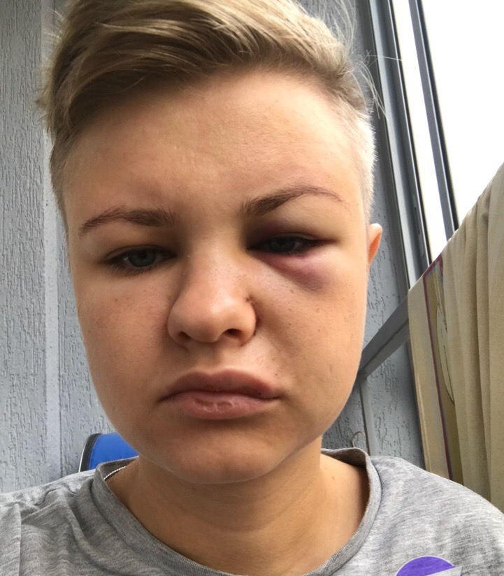 В Екатеринбурге полиция разыскивает мужчину, ударившего посетительницу гей-клуба В Екатеринбурге полиция разыскивает мужчину, ударившего посетительницу гей-клуба